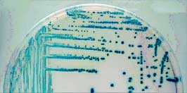 <b>Bioser S.A.</b> ofrece una gama de <i>medios de cultivo cromogénicos</i> que permiten detectar fácilmente al microorganismo y evaluar la calidad sanitaria de la carne.