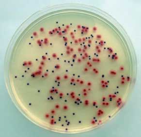 <b>Oxoid</b> ha mejorado la fórmula de <i>Oxoid Brilliance™ E. coli/coliform Selective Agar, CM1046</i>, de forma que ahora se puede poner en evidencia la reacción de indol directamente sobre la placa de cultivo, asegurando una rápida, cómoda y precisa confirmación de todas aquellas colonias presuntivas de <i>Escherichia coli</i>.