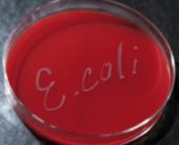 Las <i>Escherichia coli</i> productoras de shiga toxina (STEC) son una causa muy relevante de enfermedades, hospitalizaciones e incluso muertes. Se transmiten comúnmente por carne de ternera, leche cruda, quesos, zumos y vegetales.